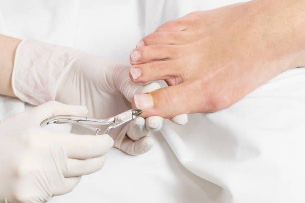 pedicure medicale (2)