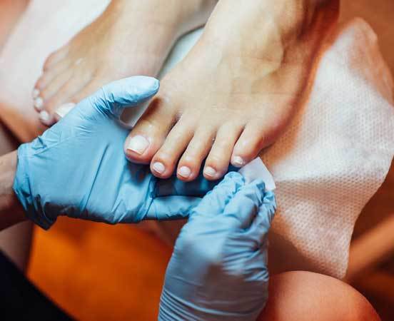 Pedicure Etterbeek