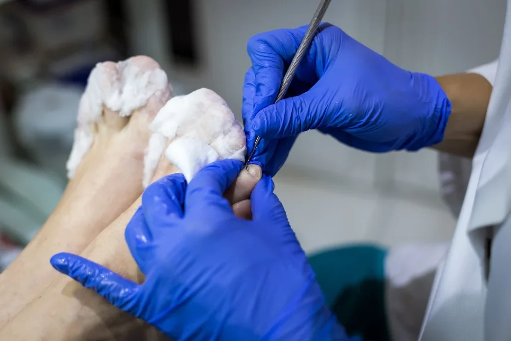 Pédicure médicale woluwe saint lambert
