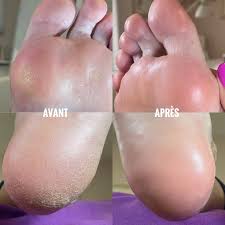 Pédicure Médicale Forest