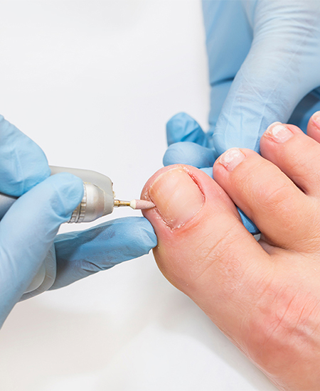 Pédicure médicale Saint Gilles