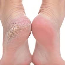 pédicure médicale ganshoren